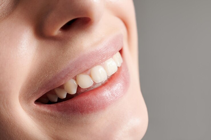 beautiful-female-smile-with-white-straight-teeth_651396-3431 Beautiful female smile with white straight teeth<br />